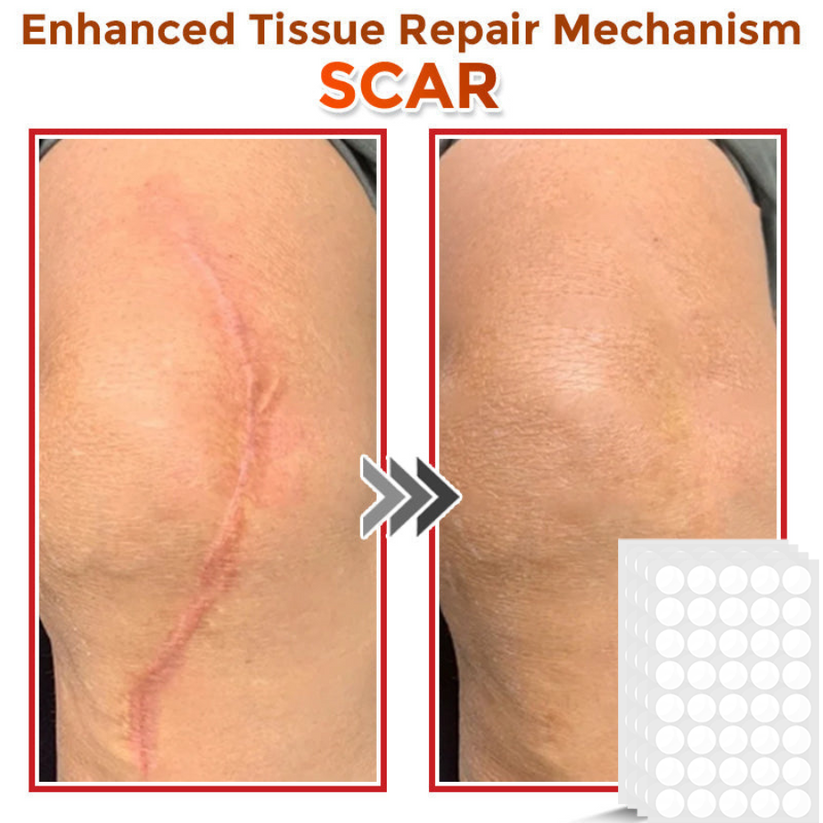 Φυτικά Έμπλαστρα Αφαίρεσης Θηλωμάτων