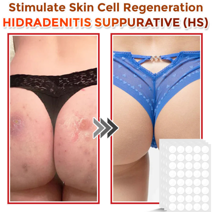 Φυτικά Έμπλαστρα Αφαίρεσης Θηλωμάτων