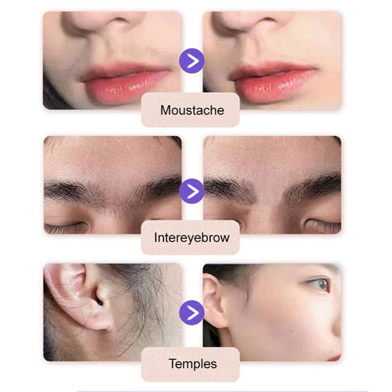 Κρέμα Για Απαλή & Ανώδυνη Αποτρίχωση