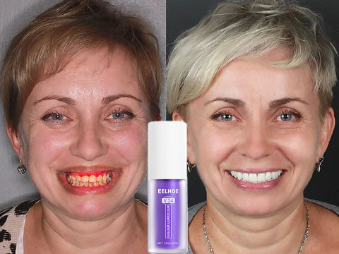 Διορθωτής Χρώματος Δοντιών & Ορός Φροντίδας Των Σμάλτων 🦷💜